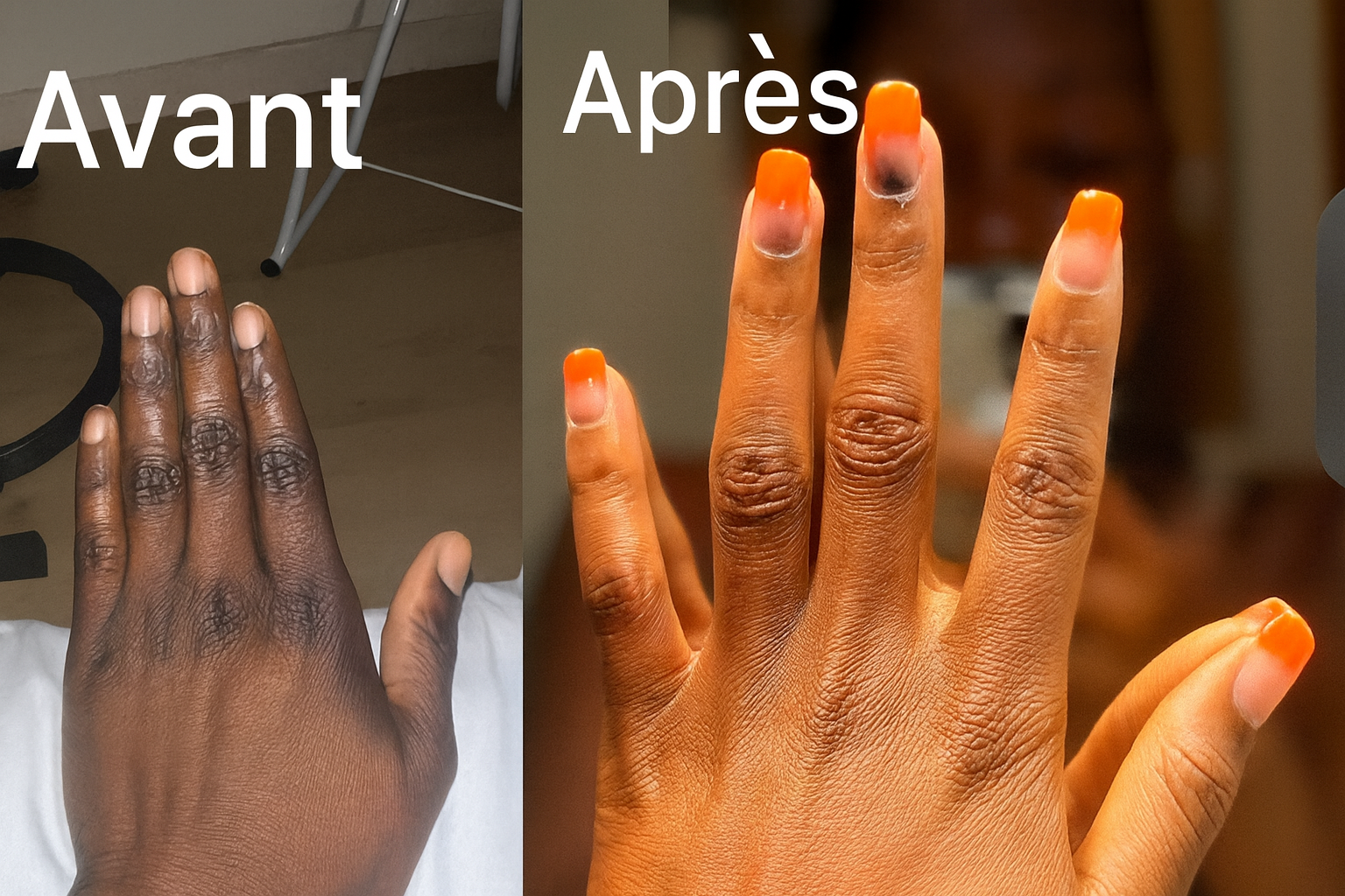 Kit Renaissance Mains & Pieds