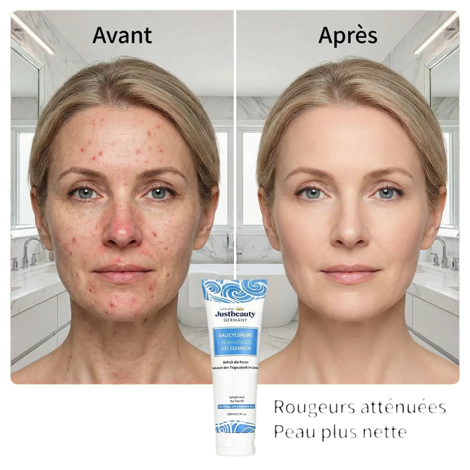 PURE SKIN SOLUTION – Nettoyant Visage Purifiant Anti-Acné; Anti-Imperfections (120 ml)