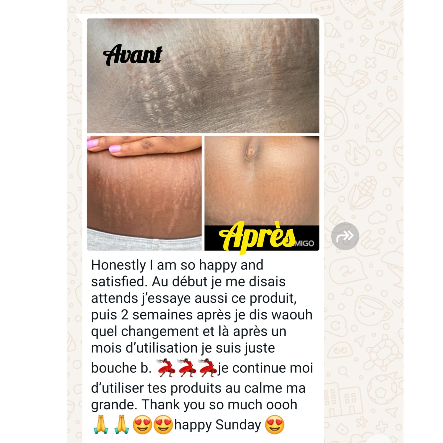 DUO CREME ET HUILE ANTIVERGETURES