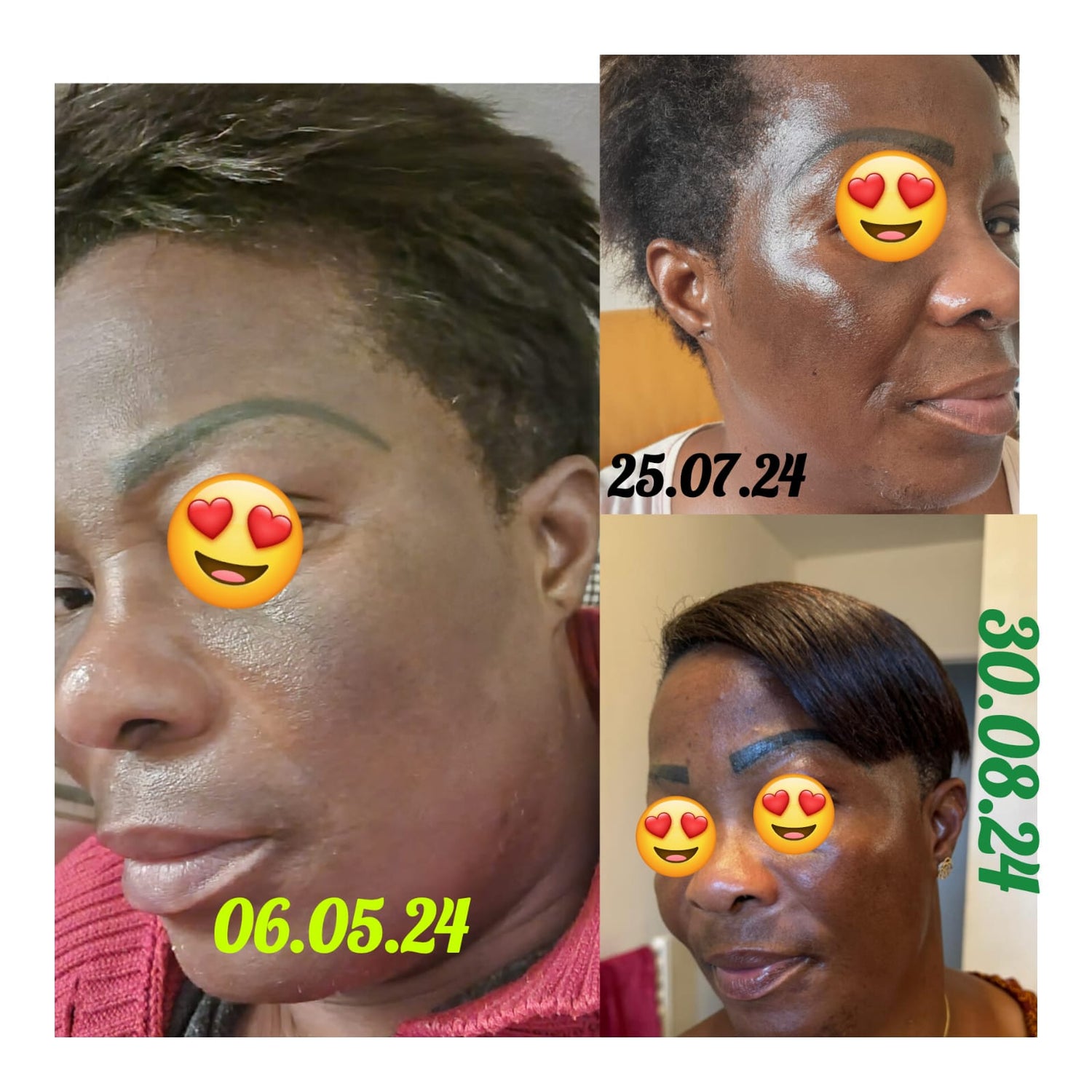 MELA REPAIR - KIT MAMIES AVEC SAVON MELA (5pcs)