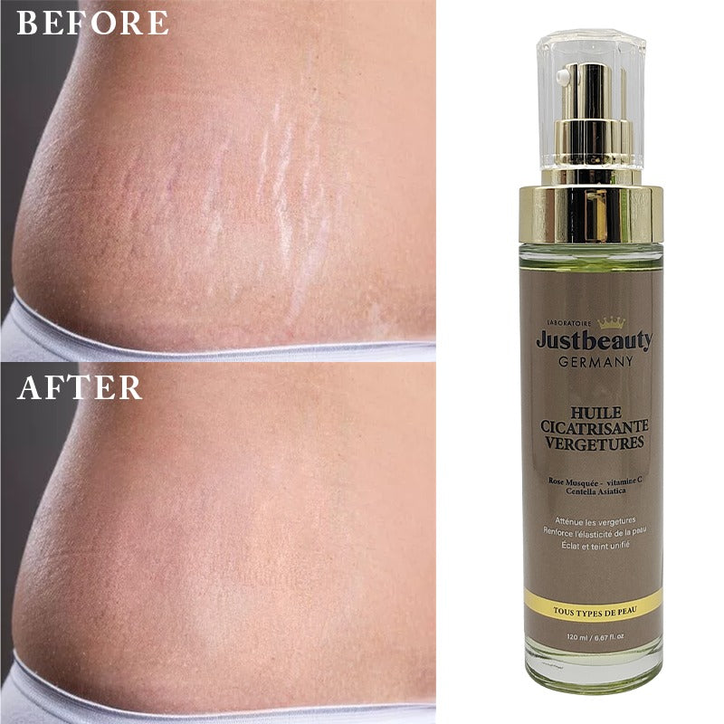 DUO EXPERT ANTI-VERGETURES