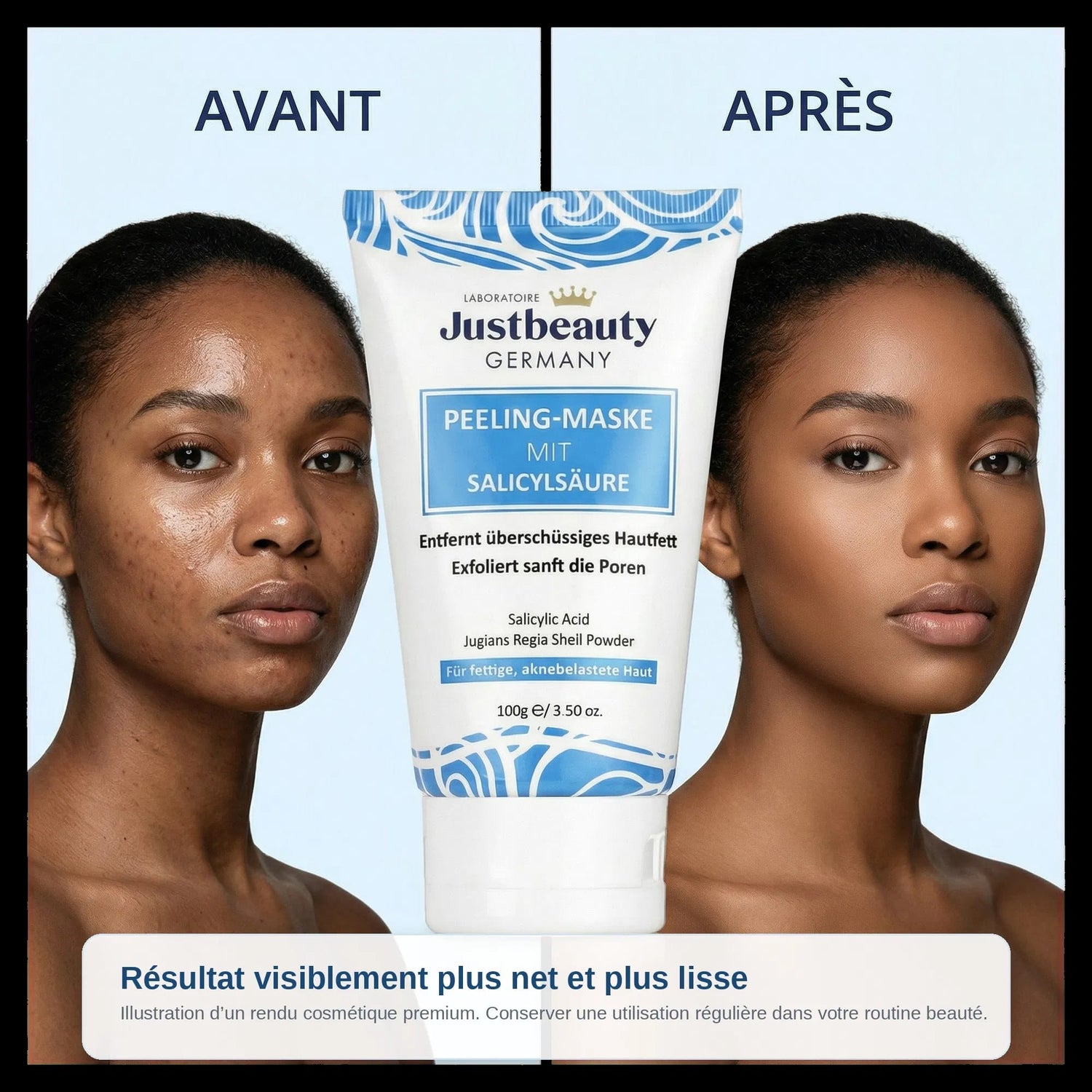 PURE SKIN SOLUTION – Masque Purifiant Anti-Acné & Anti-Imperfections 100g