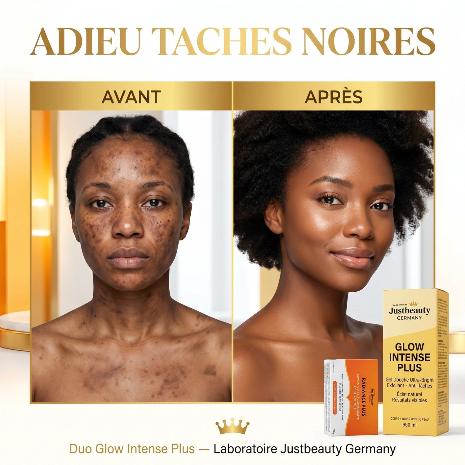 Kit Anti-Taches & Hyperpigmentation – Routine Éclat Corps pour Aider à Uniformiser le Teint avec Savon Kojique 200g + Gel Douche Éclaircissant 650ml