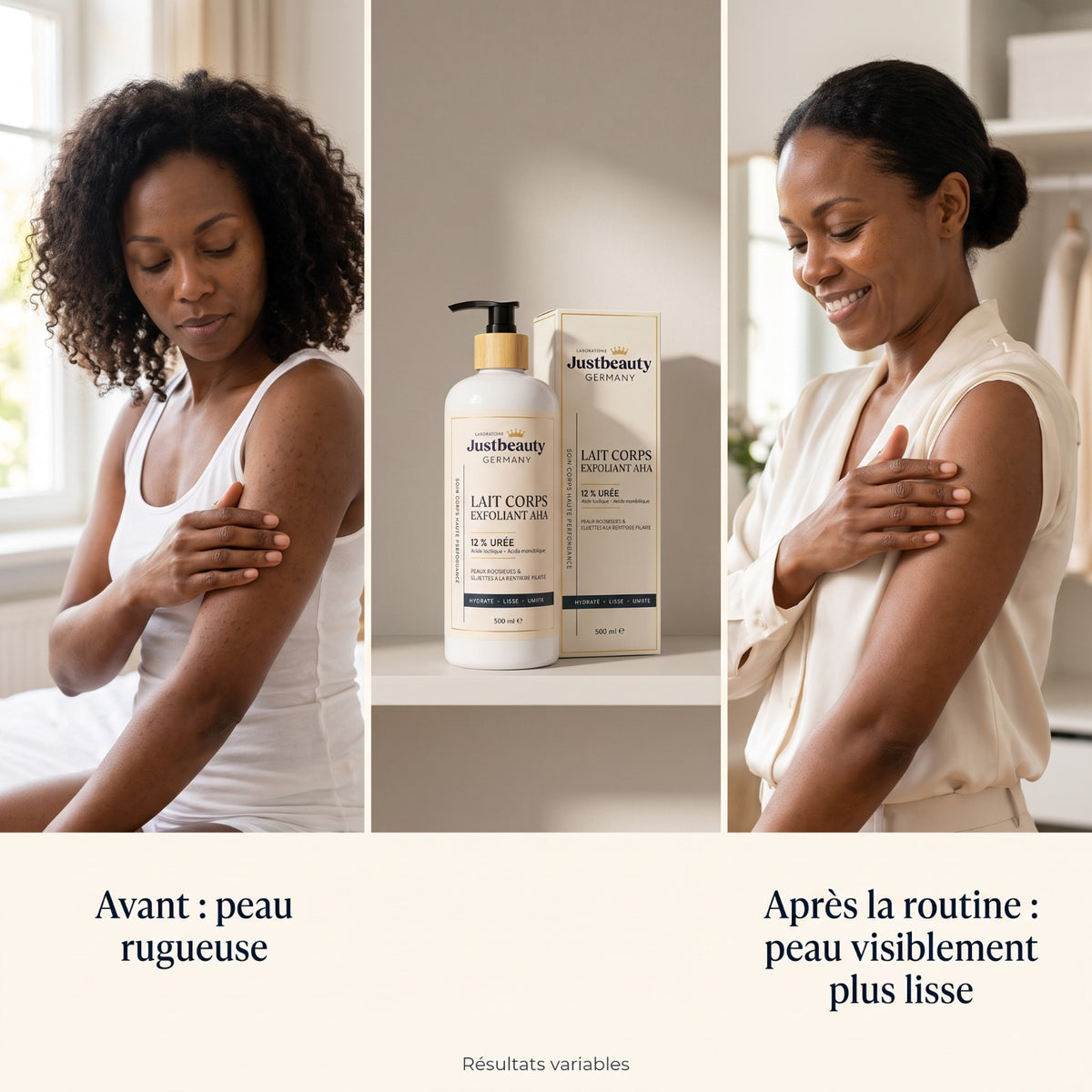 Lait Corps Exfoliant AHA 12 % Urée — Peaux Rugueuses & Kératose Pilaire — 500 ml