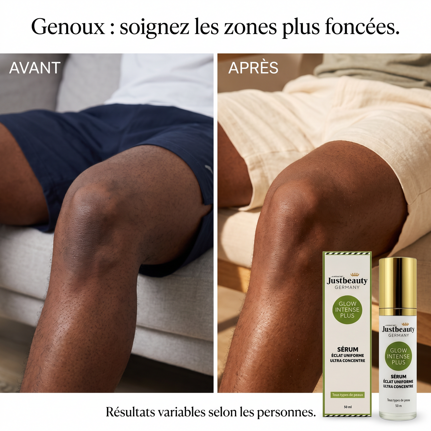 SERUM ECLAT UNIFORME POUR ZONES SOMBRES (FORMULE AMÉLIORÉE)