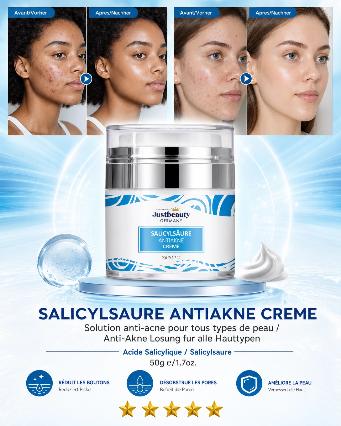 PURE SKIN SOLUTION – Gesichtscreme mit Salicylsäure (gegen Flecken und Unreinheiten) 50ML