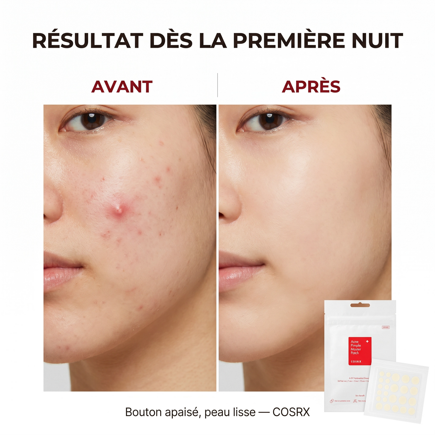 Acne & Pimple Patches /COSRX - Acne Pimple Master Patch 24 Pieces, 3 Sizes