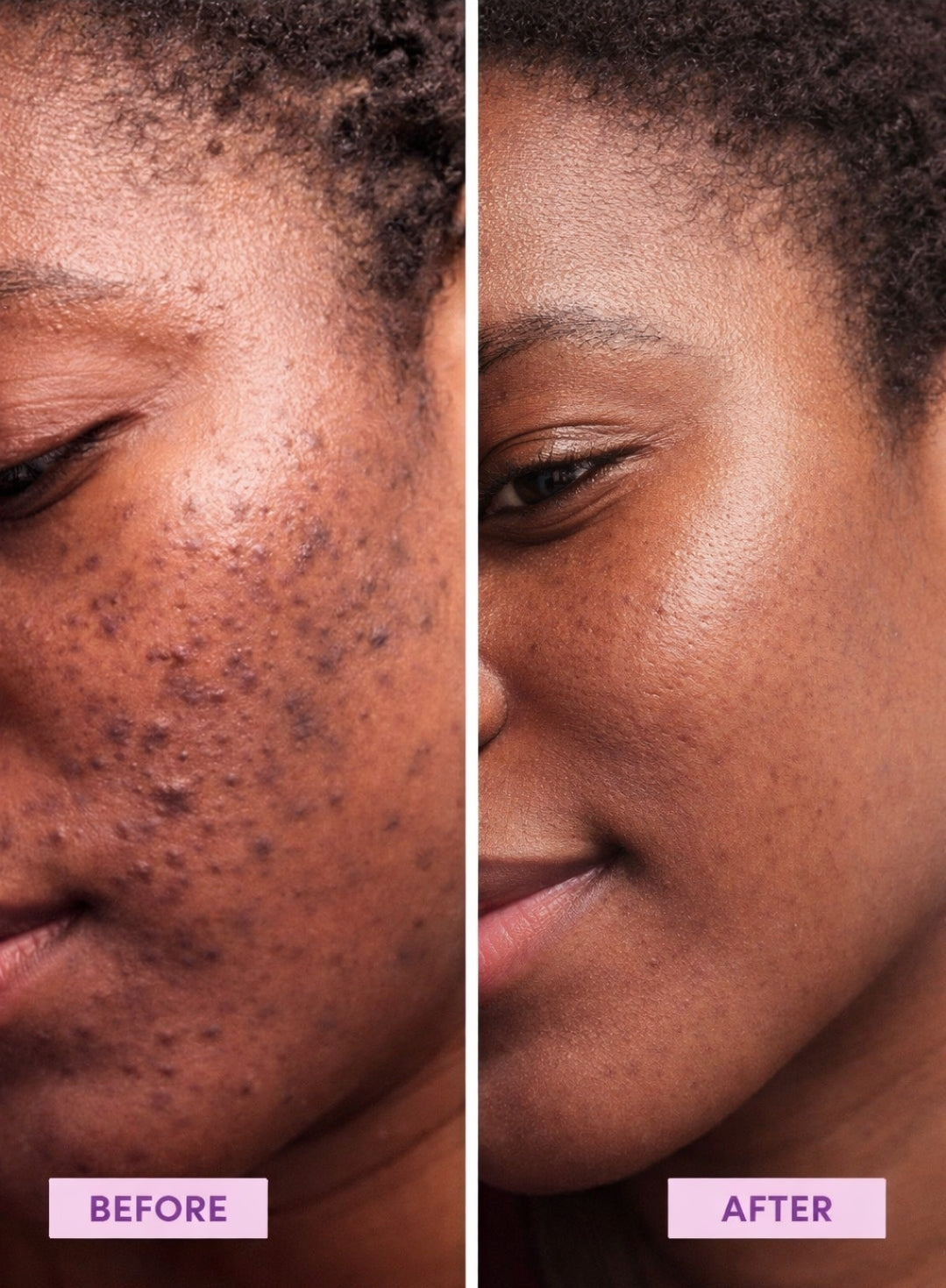 PEELING AUX ALGUES HAUTE PERFORMANCE - Peau nette - Teint uniforme - Éclat retrouvé