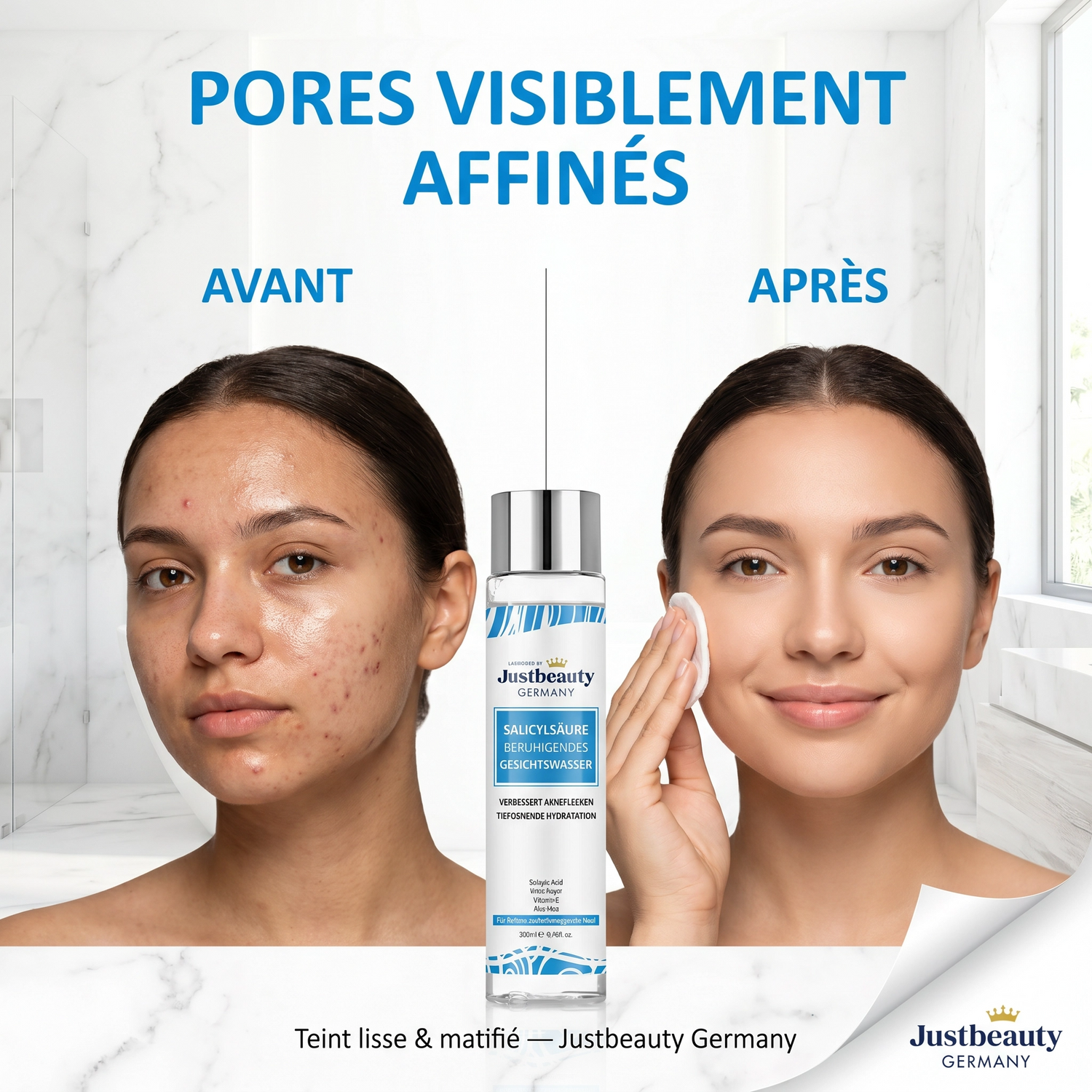 PURE SKIN SOLUTION – Anti-Acne & Anti-Blemish Purifying Toner (200 ml)