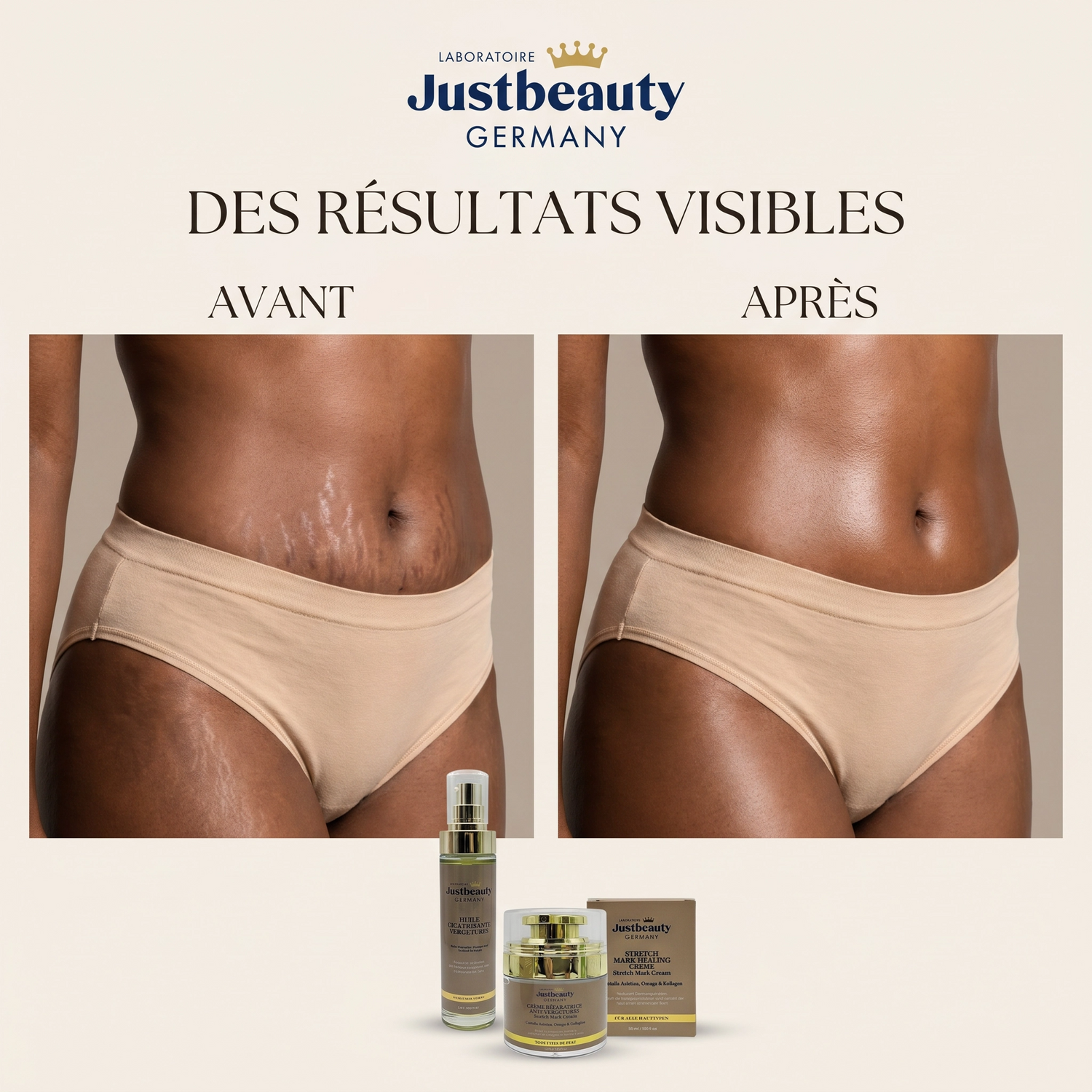 Duo Expert Anti-Vergetures – Vergetures visibles, peau relâchée & perte d’élasticité | Crème Réparatrice + Huile Cicatrisante